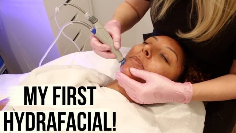 My First Hydrafacial – ACNE PRONE SKIN remedy! | BiancaReneeToday