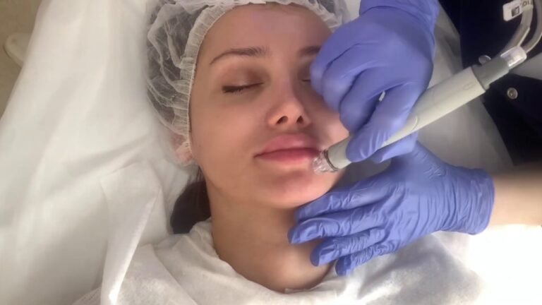 HYDRAFACIAL процедуры у косметолога и пилинг prx Т33