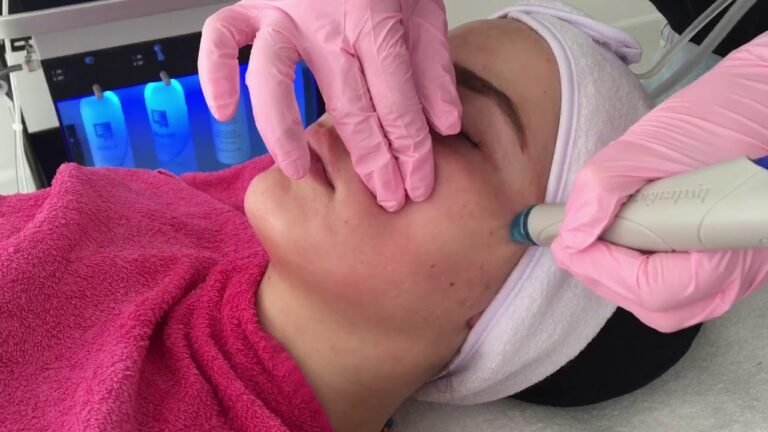 HydraFacial® Rotterdam bij Beyond Skin Aesthetics