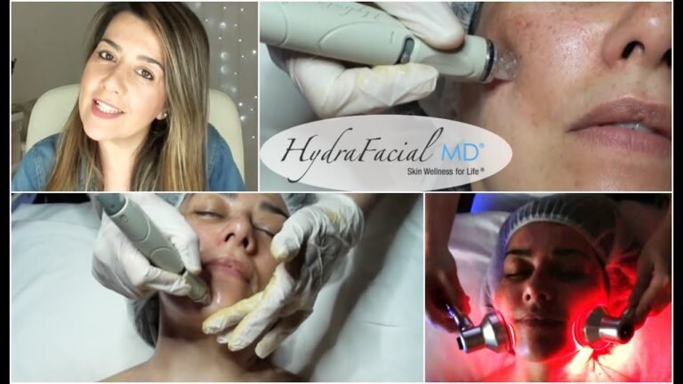 Hydrafacial Tratamiento que arrasa en Hollywood + VLOG + Review | NathuStyle