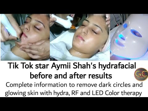 Hydrafacial treatment before and after results, tik toker star Amii Shah's skin treatment, 7 in 1