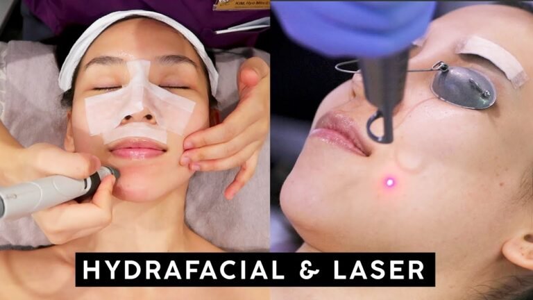 My Skincare Treatments – Hydrafacial & Laser