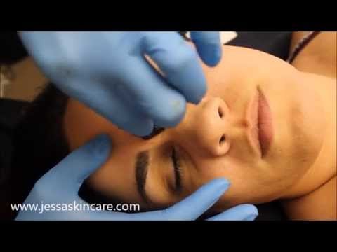 Facial Hair Removal | Sugaring Waxing Eyebrows, Lip, Nose Sugar Wax | Esthetician School