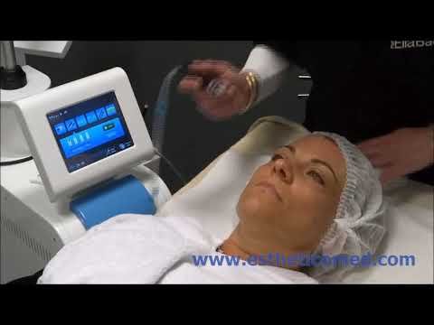 HYDRAFACIAL / DERMABRASION,  Processus
