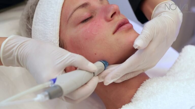 HydraFacial at Nova Clinic Dubai – Award Winning Facial Treatment