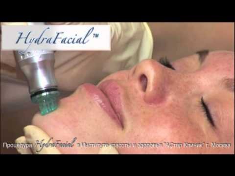HydraFacial в АСтар Клиник (косметология лица и тела)