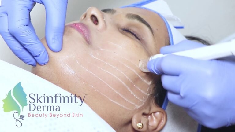 Hydrafacial Treatment.