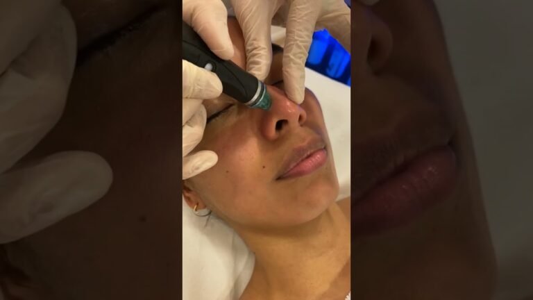 Hydrafacial protocolo Deluxe