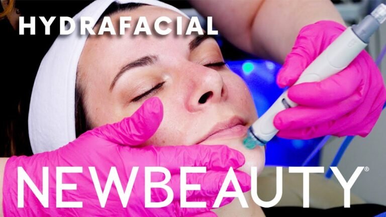 This is What HydraFacial Sucked out of my Pores | NewBeauty Tries | NewBeauty