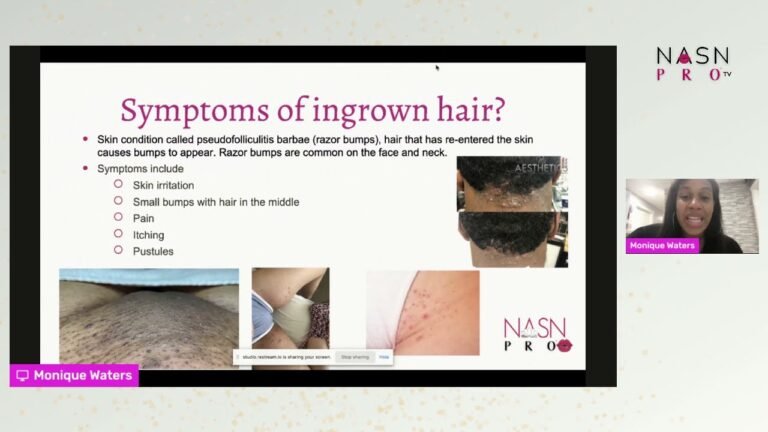 Vajacials & Ingrown Hair Treatments for Estheticians with Monique Waters