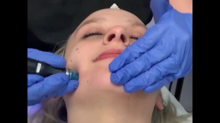 Wet Diamond Hydrafacial