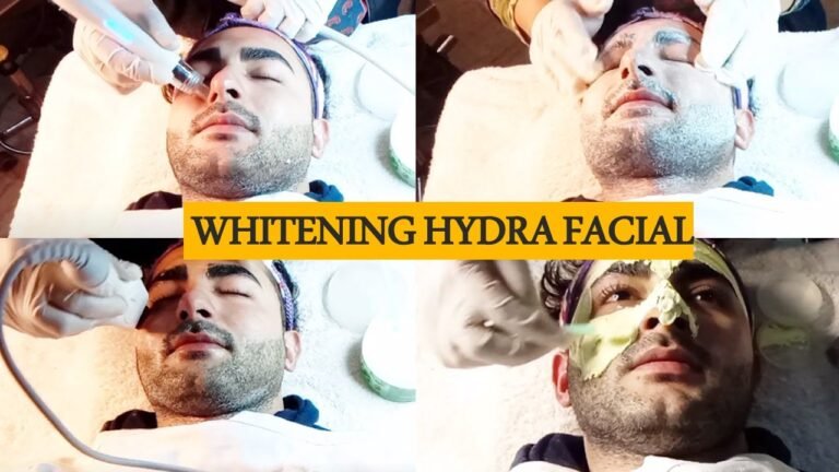 whitening Hydrafacial | Best Hydrafacial For Men | My Result Hydrafacial Before and After