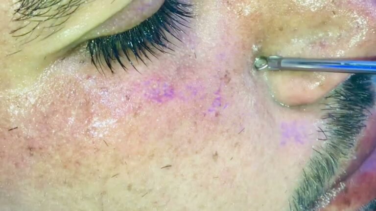 تنظيف البشره 👃ازاله الدهون "تفتيح مسام البشره