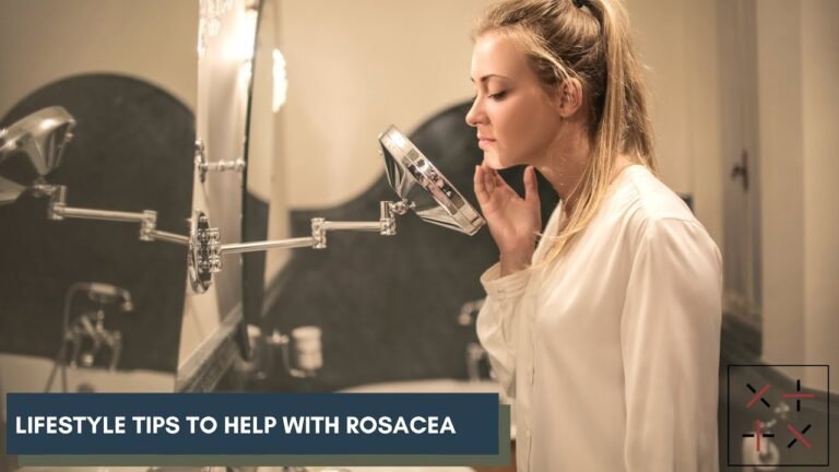 Lifestyle tips to help with Rosacea