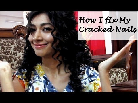 How I Fix My Cracked Nails | Indian Fashion Channel